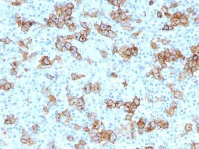 Immunohistochemistry-Paraffin: CD30/TNFRSF8 Antibody (Ki-1/779) [NBP2-44561]