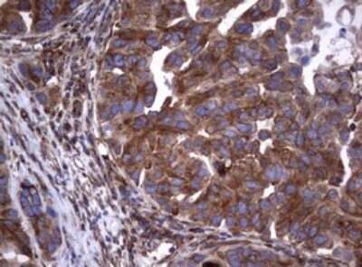 Immunohistochemistry: CD30/TNFRSF8 Antibody (OTI1C6) - Azide and BSA Free [NBP2-70374]
