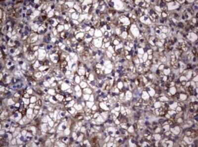 Immunohistochemistry: CD30/TNFRSF8 Antibody (OTI1C6) - Azide and BSA Free [NBP2-70374]