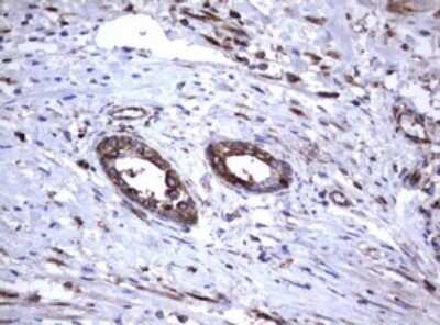 Immunohistochemistry: CD30/TNFRSF8 Antibody (OTI1C6) - Azide and BSA Free [NBP2-70374]