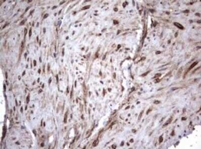 Immunohistochemistry: CD30/TNFRSF8 Antibody (OTI1C6) - Azide and BSA Free [NBP2-70374]