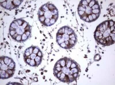 Immunohistochemistry: CD30/TNFRSF8 Antibody (OTI1C6) - Azide and BSA Free [NBP2-70374]