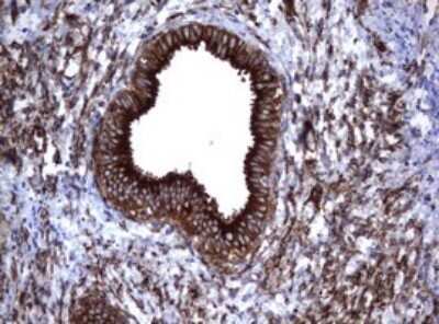 Immunohistochemistry: CD30/TNFRSF8 Antibody (OTI1C6) - Azide and BSA Free [NBP2-70374]