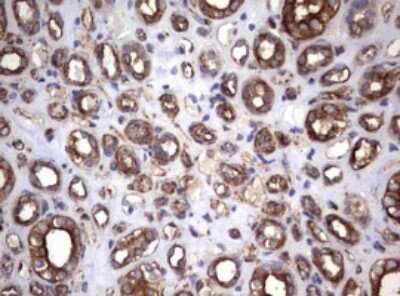 Immunohistochemistry: CD30/TNFRSF8 Antibody (OTI1C6) - Azide and BSA Free [NBP2-70374]