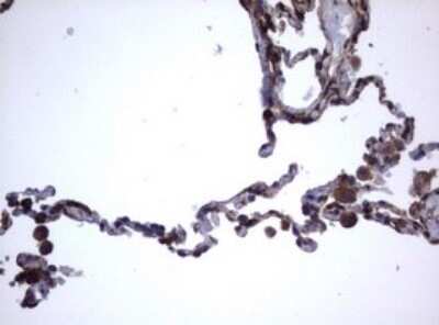 Immunohistochemistry: CD30/TNFRSF8 Antibody (OTI1C6) - Azide and BSA Free [NBP2-70374]