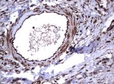 Immunohistochemistry: CD30/TNFRSF8 Antibody (OTI1C6) - Azide and BSA Free [NBP2-70374]