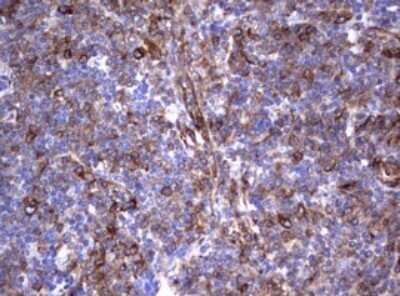 Immunohistochemistry: CD30/TNFRSF8 Antibody (OTI1C6) - Azide and BSA Free [NBP2-70374]