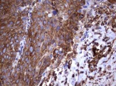 Immunohistochemistry: CD30/TNFRSF8 Antibody (OTI1C6) - Azide and BSA Free [NBP2-70374]