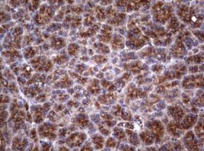 Immunohistochemistry: CD30/TNFRSF8 Antibody (OTI1C6) - Azide and BSA Free [NBP2-70374]