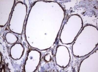 Immunohistochemistry: CD30/TNFRSF8 Antibody (OTI1C6) - Azide and BSA Free [NBP2-70374]