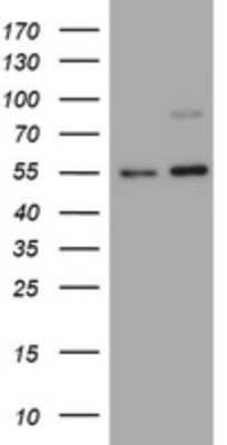 Western Blot: CD30/TNFRSF8 Antibody (OTI1C6)Azide and BSA Free [NBP2-70374]