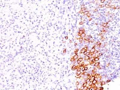 Immunohistochemistry-Paraffin: CD30/TNFRSF8 Antibody (SPM609) - Azide and BSA Free [NBP2-47907]