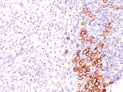 Immunohistochemistry-Paraffin: CD30/TNFRSF8 Antibody (SPM609) - IHC-Prediluted [NBP2-48313]