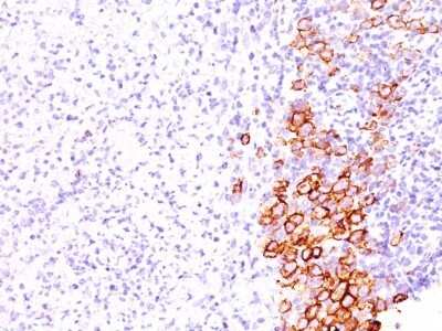 Immunohistochemistry-Paraffin: CD30/TNFRSF8 Antibody (SPM609) [NBP2-44562]