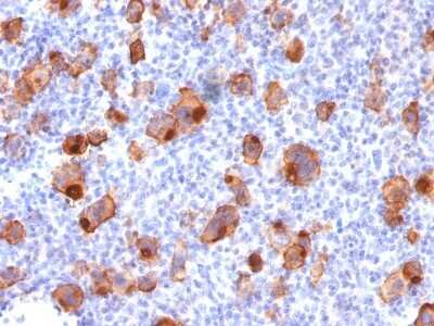 Immunohistochemistry-Paraffin: CD30/TNFRSF8 Antibody (rKi-1/779) [NBP2-53300]