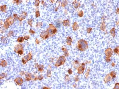 Immunohistochemistry-Paraffin: CD30/TNFRSF8 Antibody (rKi-1/779) - Azide and BSA Free [NBP2-54340]