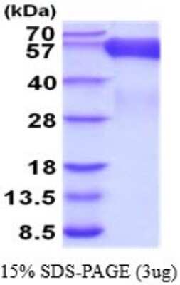 SDS-PAGE: Recombinant Human CD30/TNFRSF8 His Protein [NBP2-52222]