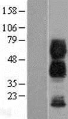 Western Blot: CD300a/LMIR1 Overexpression Lysate [NBP2-07516]