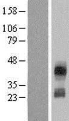 Western Blot: CD300c Overexpression Lysate [NBL1-08931]