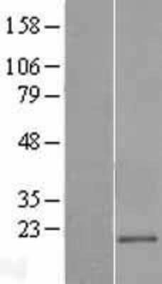 Western Blot: CD300e/LMIR6 Overexpression Lysate [NBP2-04925]