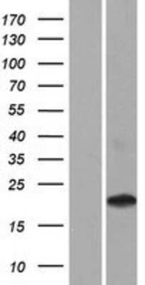 Western Blot: CD300d Overexpression Lysate [NBP2-09404]