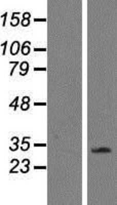 Western Blot: CD300f/LMIR3/CD300LF Overexpression Lysate [NBP2-05598]