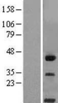 Western Blot: CD300LG/Nepmucin Overexpression Lysate [NBL1-08933]