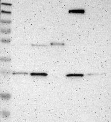 Western Blot: CD300a/LMIR1 Antibody [NBP3-17815]