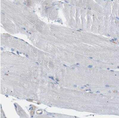 Immunohistochemistry-Paraffin: CD300e/LMIR6 Antibody [NBP1-84592]
