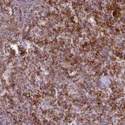 Immunohistochemistry: CD300f/LMIR3/CD300LF Antibody [NBP2-14463]