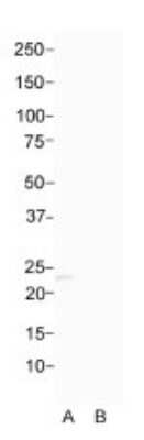 Western Blot: CD300f/LMIR3/CD300LF Antibody [NBP3-10774]