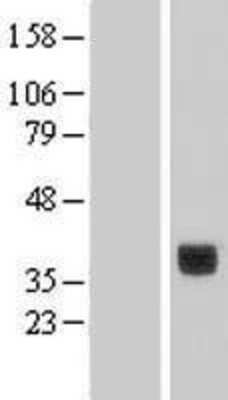 Western Blot: CLEC10A/CD301 Overexpression Lysate [NBL1-09254]