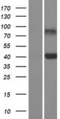 Western Blot: CLEC10A/CD301 Overexpression Lysate [NBP2-11302]