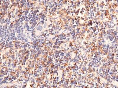 Immunohistochemistry-Paraffin: CD302/CLEC13A Antibody (071) [NBP2-90687]