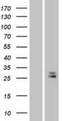 Western Blot: CD302/CLEC13A Overexpression Lysate [NBP2-04346]