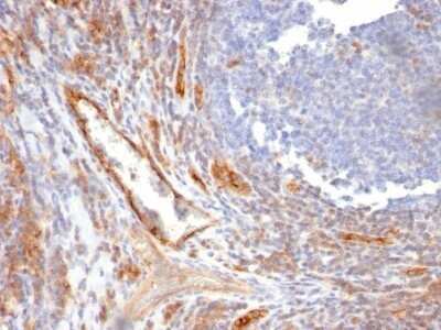 Immunohistochemistry-Paraffin: CD31/PECAM-1 Antibody (C31.10) - IHC-Prediluted [NBP2-48330]