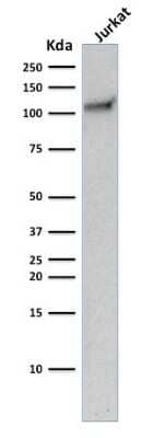 Western Blot: CD31/PECAM-1 Antibody (C31.10) [NBP2-44340]