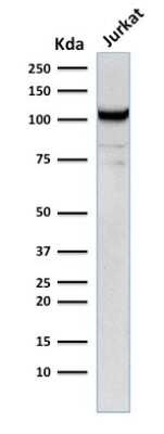 Western Blot: CD31/PECAM-1 Antibody (C31.12) [NBP2-53362]