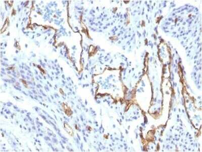 Immunohistochemistry-Paraffin: CD31/PECAM-1 Antibody (C31/1395R) - Azide and BSA Free [NBP2-54385]