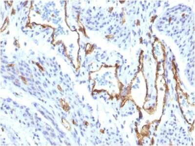 Immunohistochemistry-Paraffin: CD31/PECAM-1 Antibody (C31/1395R) [NBP2-53340]