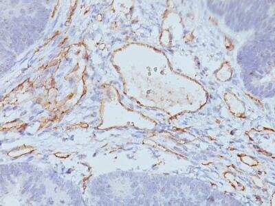 Immunohistochemistry-Paraffin: CD31/PECAM-1 Antibody (C31.3 + C31.7 + C31.10) - IHC-Prediluted [NBP2-48331]