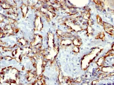 Immunohistochemistry-Paraffin: CD31/PECAM-1 Antibody (C31.3 + C31.7 + C31.10) [NBP2-44342]