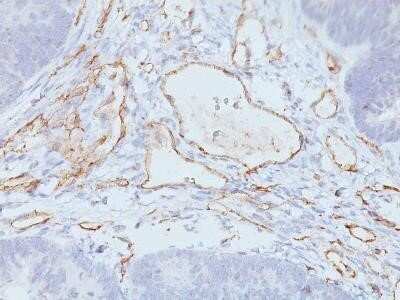 Immunohistochemistry-Paraffin: CD31/PECAM-1 Antibody (C31.3 + JC/70A) - IHC-Prediluted [NBP2-44336]