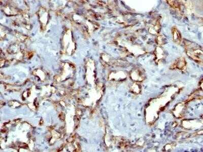 Immunohistochemistry-Paraffin: CD31/PECAM-1 Antibody (C31.3 + JC/70A) - IHC-Prediluted [NBP2-44336]