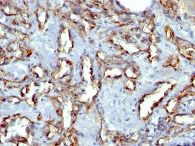 Immunohistochemistry-Paraffin: CD31/PECAM-1 Antibody (C31.3 + JC/70A) [NBP2-34283]