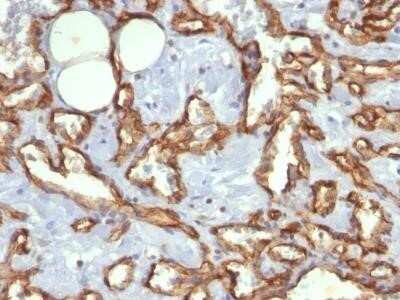 Immunohistochemistry-Paraffin: CD31/PECAM-1 Antibody (C31.3) - IHC-Prediluted [NBP2-44334]