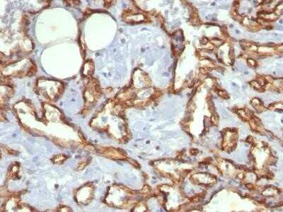 Immunohistochemistry-Frozen: CD31/PECAM-1 Antibody (C31.3) [NBP2-15202]