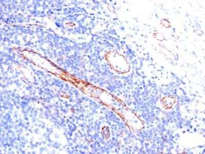 Immunohistochemistry-Paraffin: CD31/PECAM-1 Antibody (C31.3) [NBP2-15202]