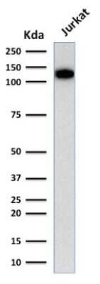 Western Blot: CD31/PECAM-1 Antibody (C31.3) [NBP2-15202]