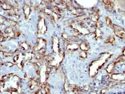 Immunohistochemistry-Paraffin: CD31/PECAM-1 Antibody (C31.7) - IHC-Prediluted [NBP2-44333]